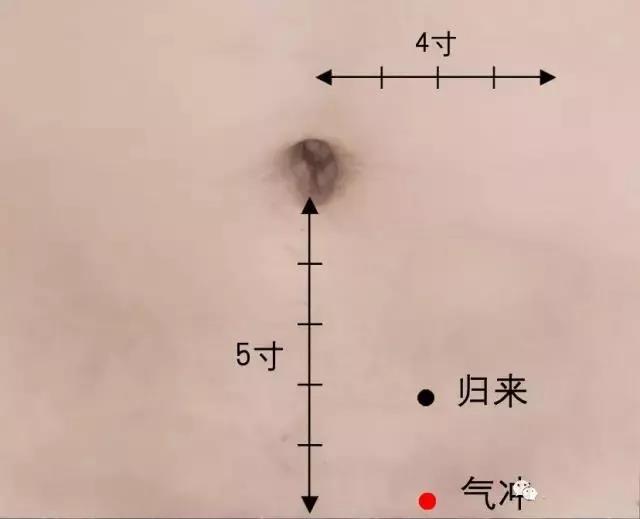 　一艾灸就上火，這是為什么?