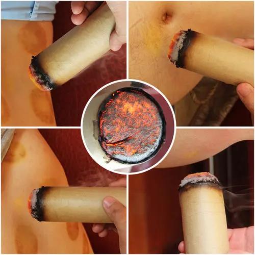 灸溫，到底是燙的好還是溫的好？為什么有的人感覺不到熱?