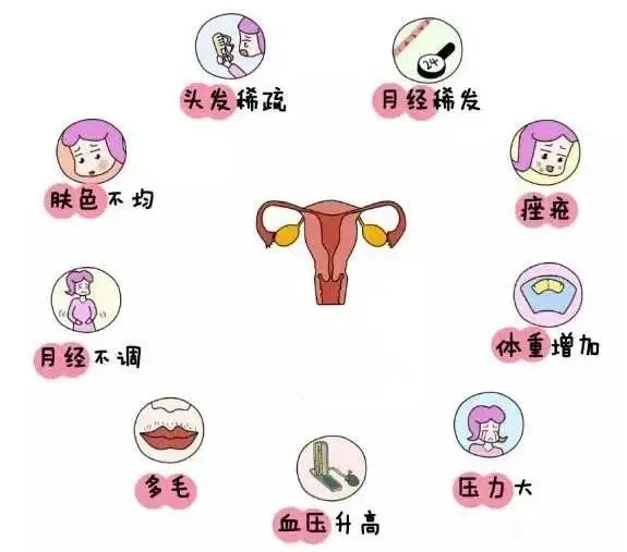 10個女人就有1個患多囊！被它纏上不要怕，艾灸幫你調“多囊”！